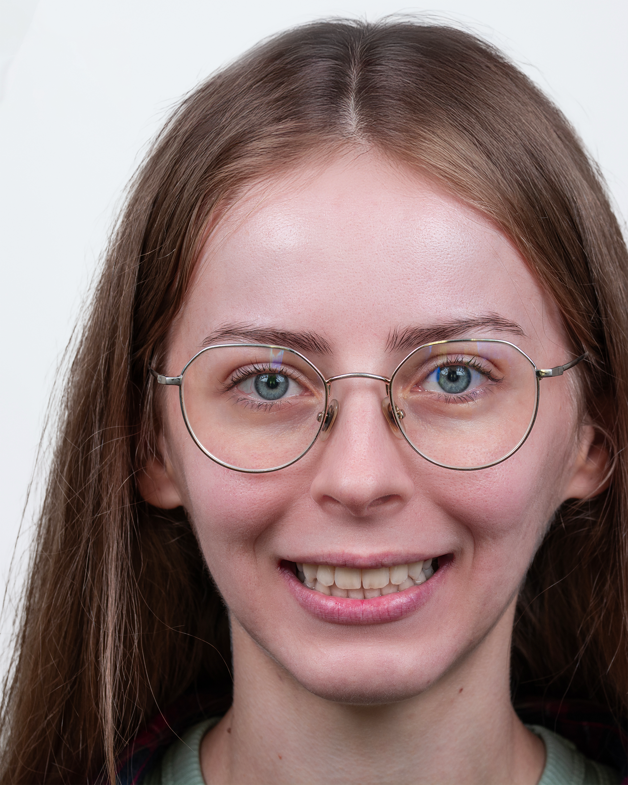 Anastasia după tratament ortodontic